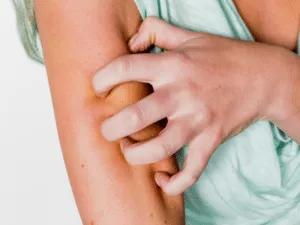 insetto scleroderma domesticum