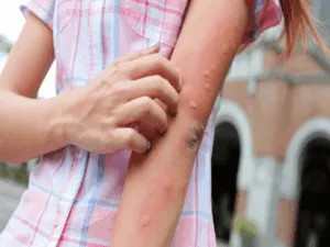 tafani insetto